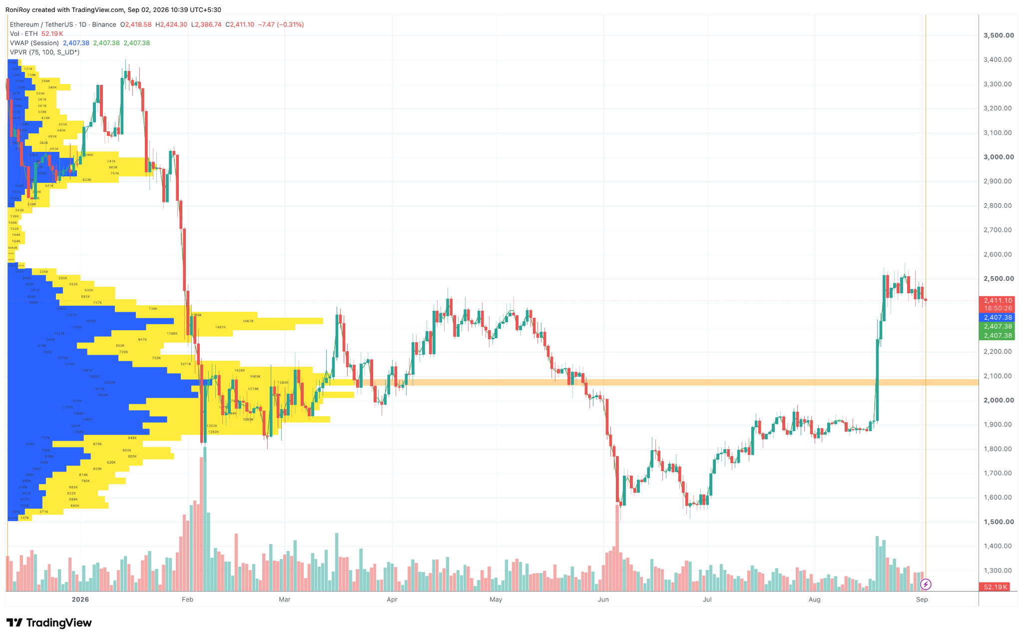 ETH/USDT 1‑Tages‑Preischart. Quelle: TradingView.